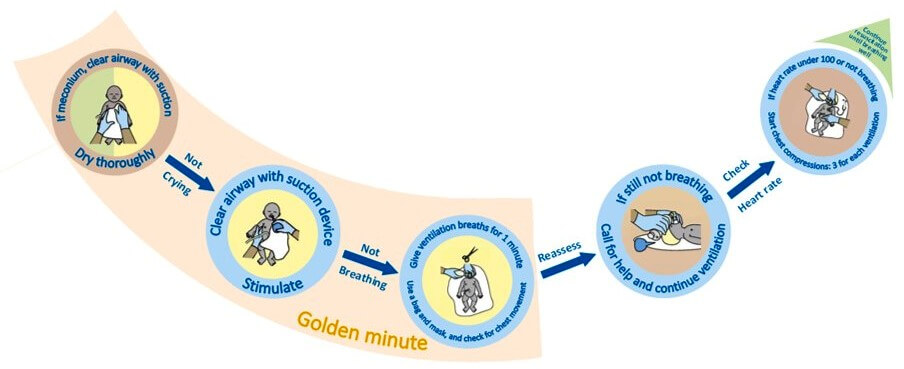 Golden Minute Instructions on the BabySaver resuscitation kit