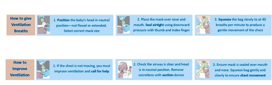 Instructions on the BabySaver resuscitation kit